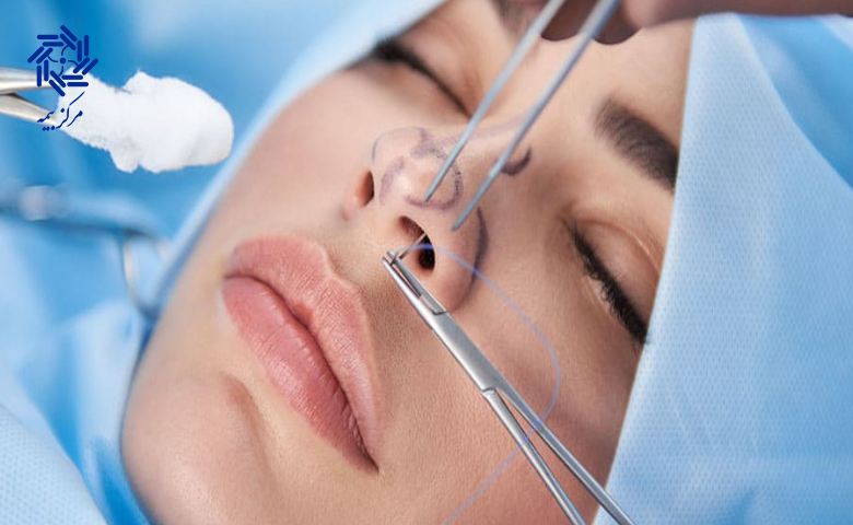 استفاده بیمه تکمیلی برای عمل زیبایی